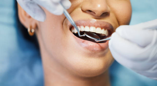 Best Chipped Tooth Repair Near Me  in Iowa Park, TX